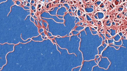 burgdorferi FocusFillMaxWyIwLjAwIiwiMC4wMCIsMTIwMCw2MzBd