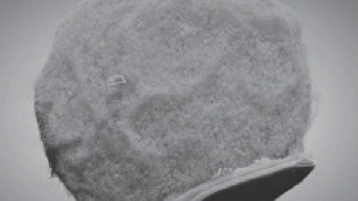 Tiny chips hitch a ride on immune cells to sites of inflammation 1 cell chip