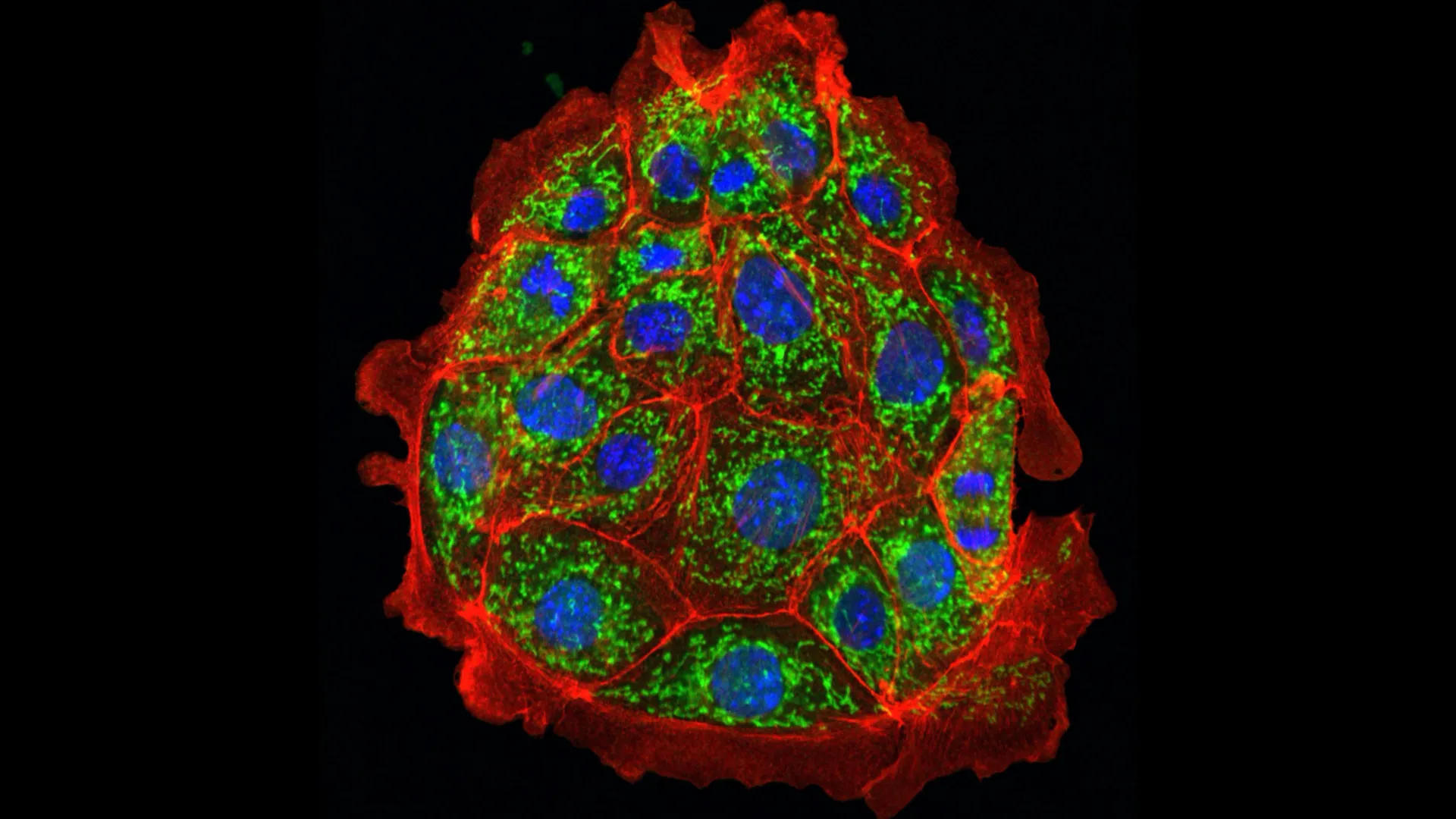 kidney proximal tubule cells.webp