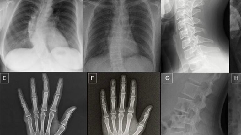 real x rays and AI generated fakes 1200x675