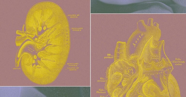 startup Making Organ Sacks Science