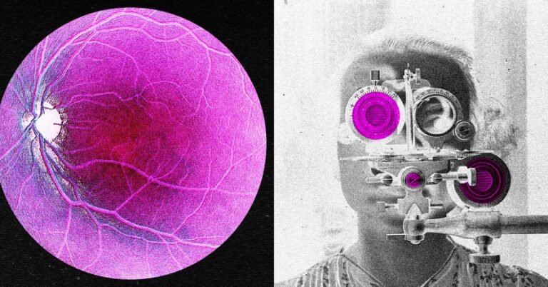 060926 Longevity Startup Eye Testing