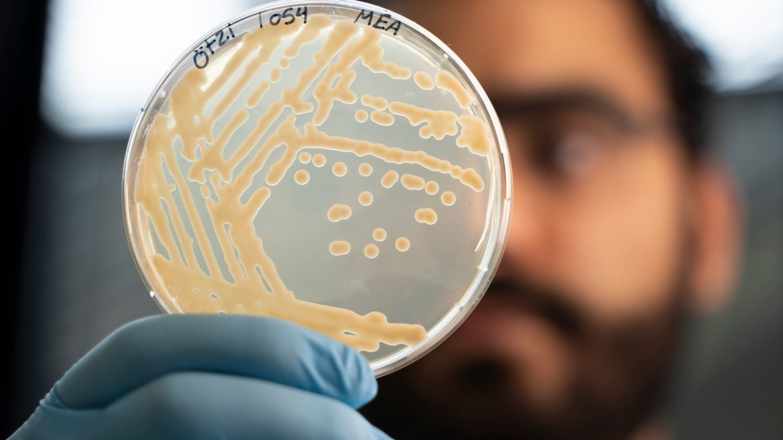 Otzi stomach yeast w Sarhan