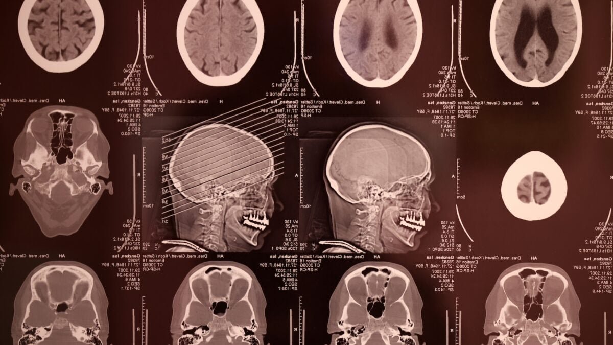 Brainimages
