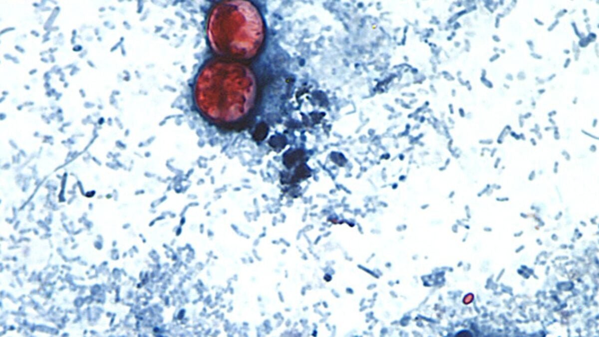 Cyclospora
